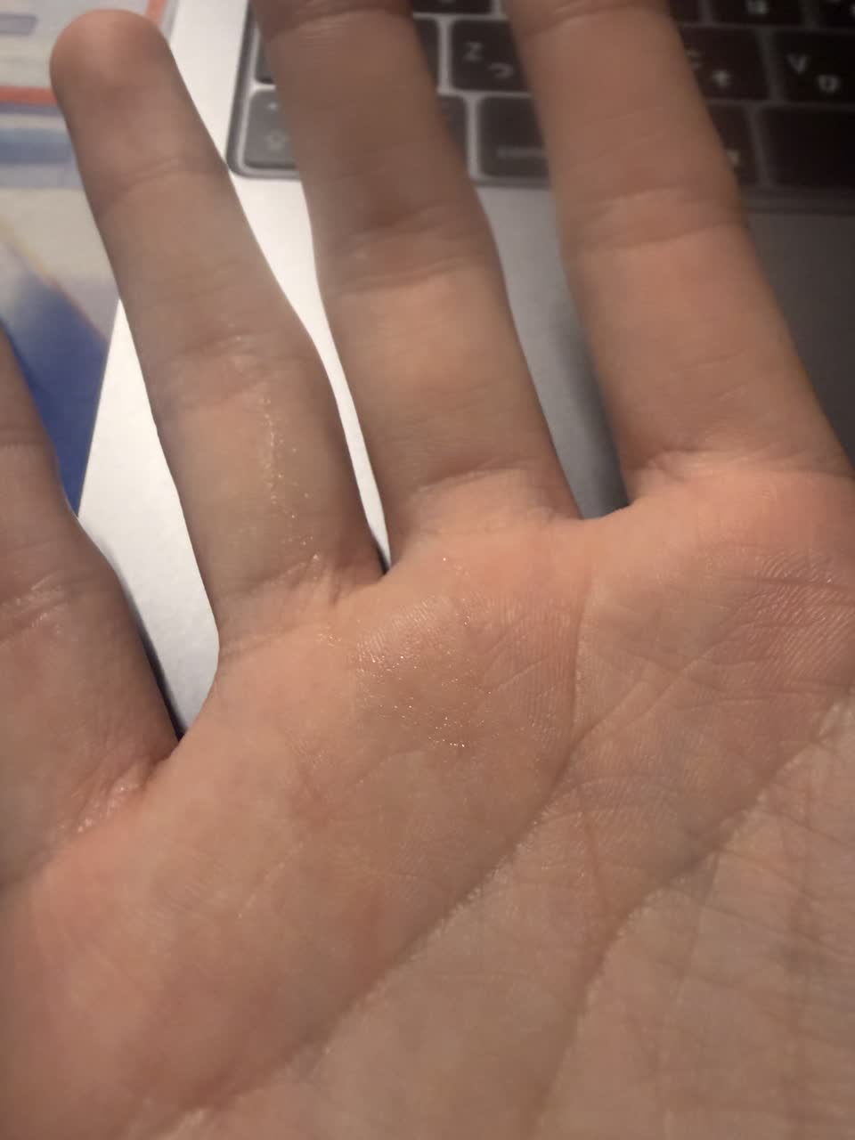 白滴さんのポストに添えられた画像